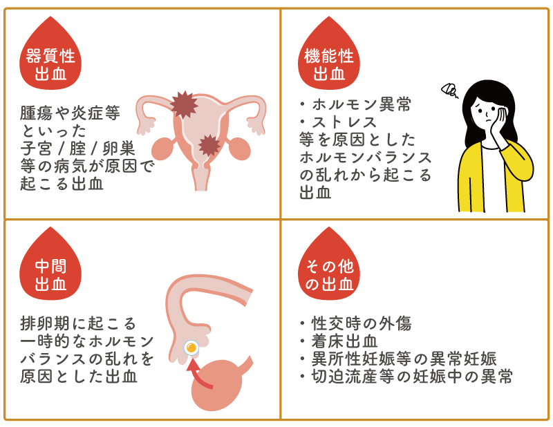 不正出血の種類